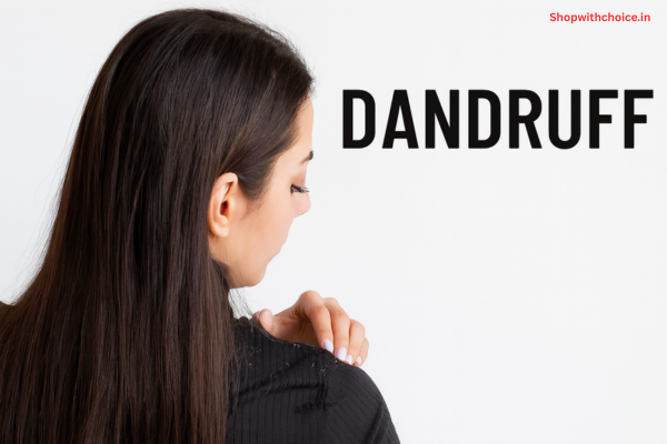 What Is Dandruff? Causes, Symptoms and Effective Treatment Explained