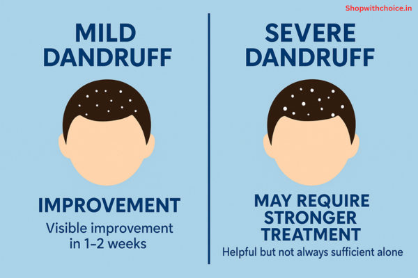 Scalpe Pro Daily Anti-Dandruff Shampoo Review: Does It Really Work for Dandruff?